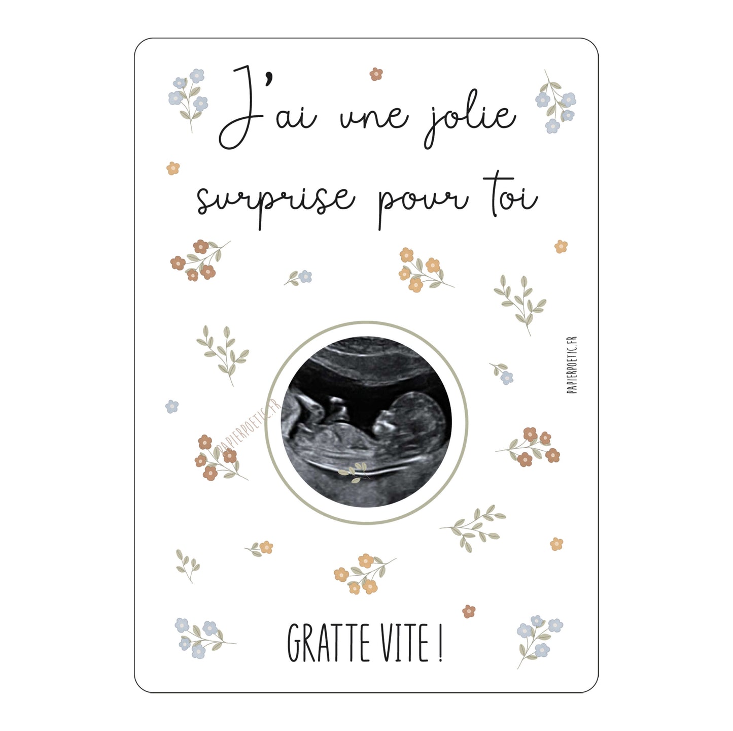 Carte à gratter “échographie”