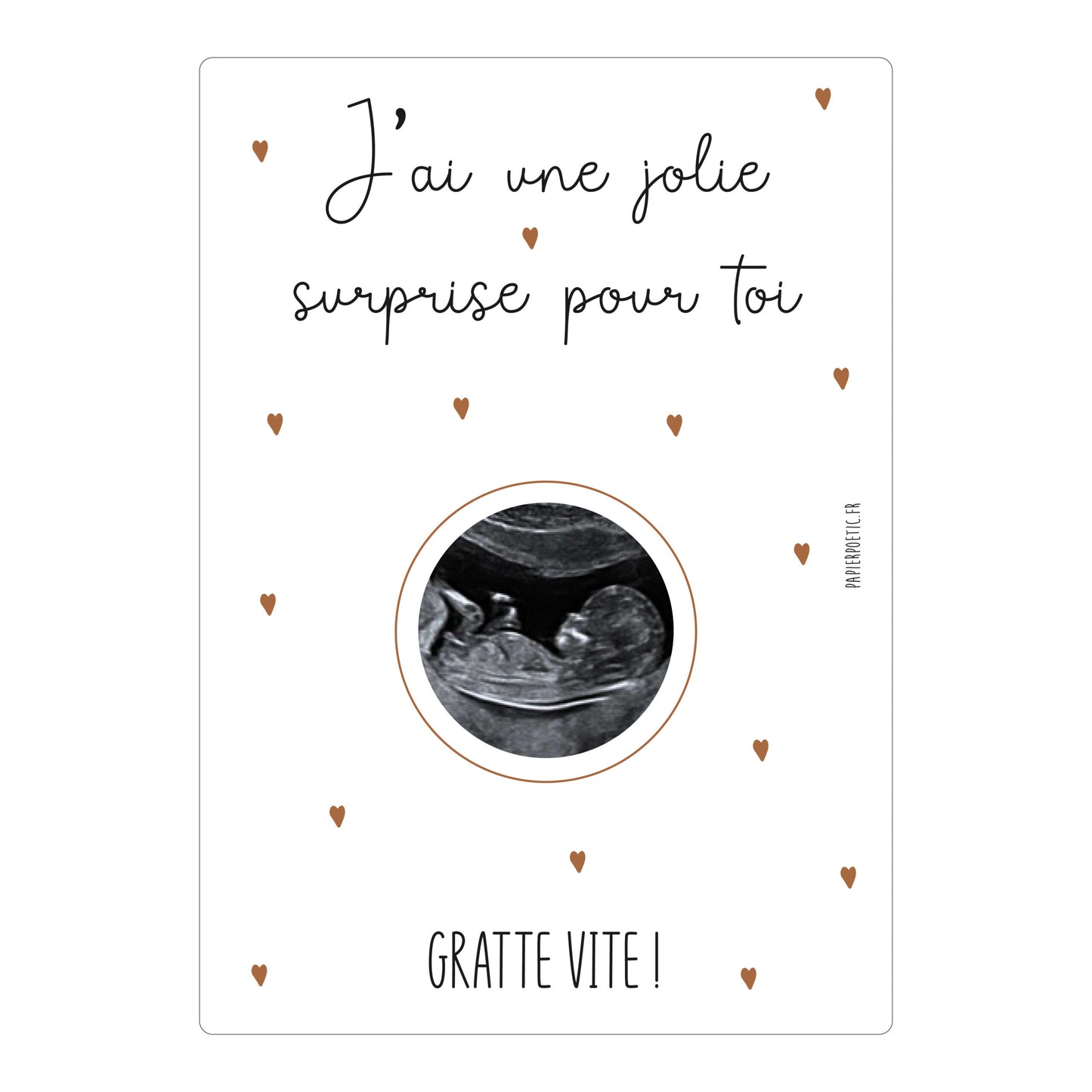 Carte à gratter “échographie”
