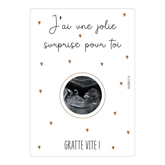 Carte à gratter “échographie”